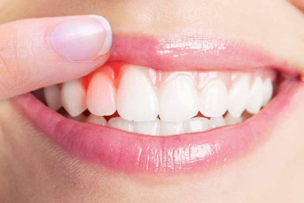 Best Vitamins for Teeth & Gums